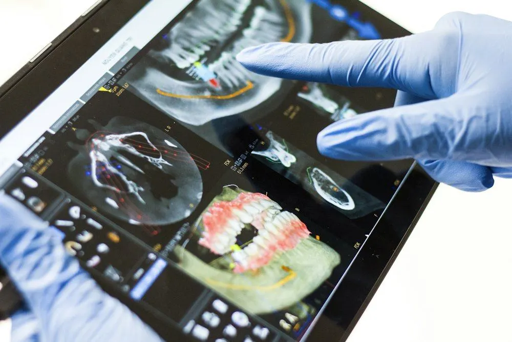 Profesional señalando un escáner dental en una tableta