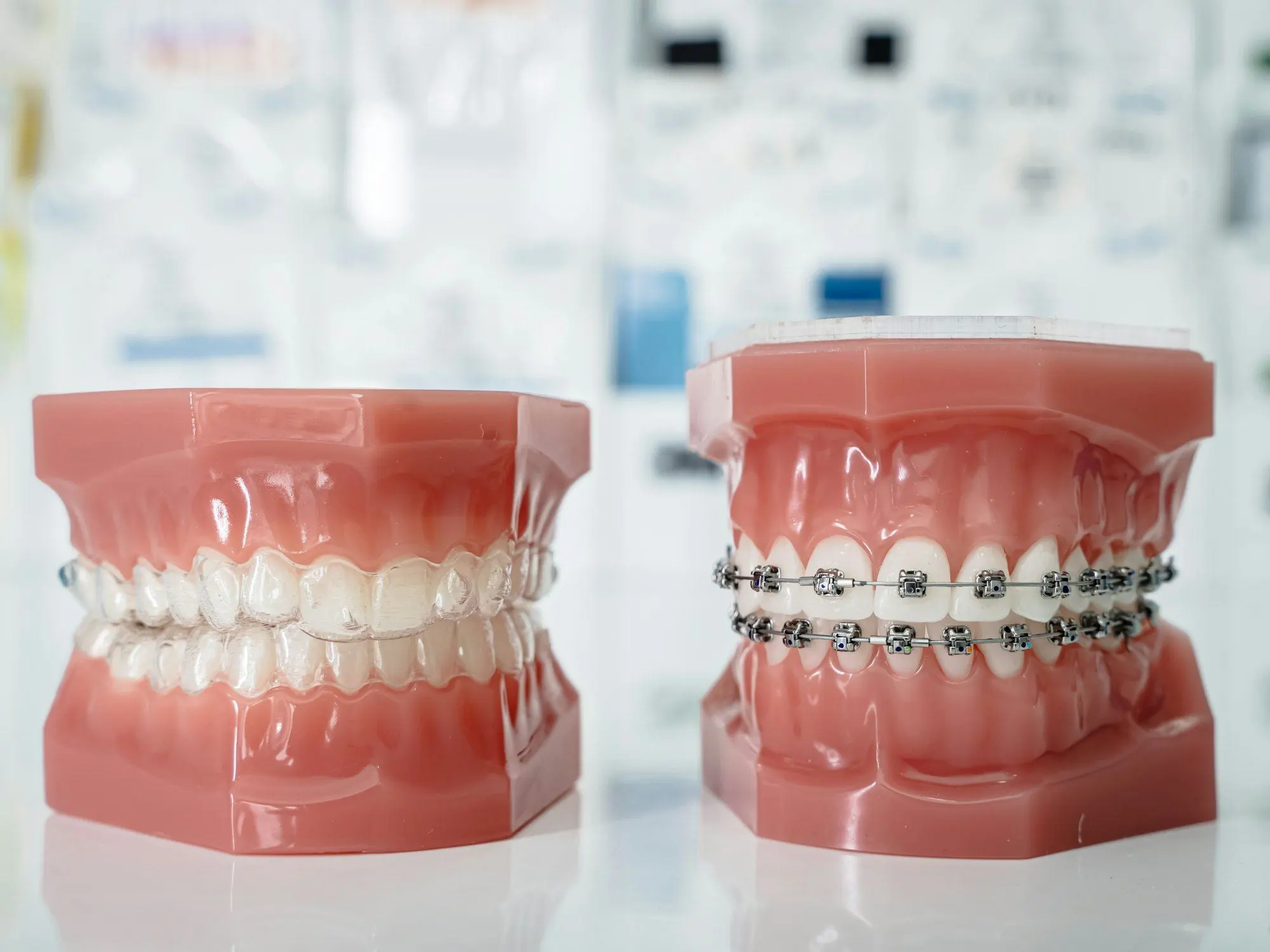 Modelos dentales con brackets de ortodoncia
